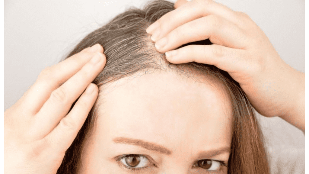 hair fall with white bulb