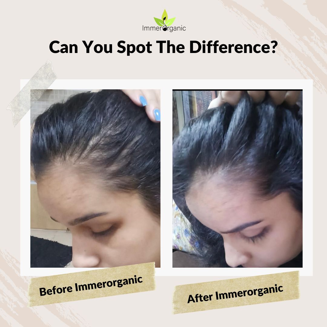 Curly Hair in India Natural Hair Products, Curly Hair in India, hair fall, hair loss , hair growth treatment, treatment, before after, curly hair loss, Immer Organic's Treatment