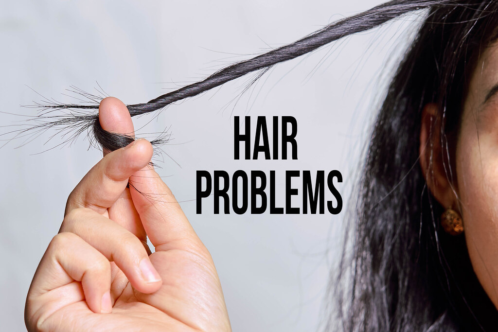 how to diagnose hair fall