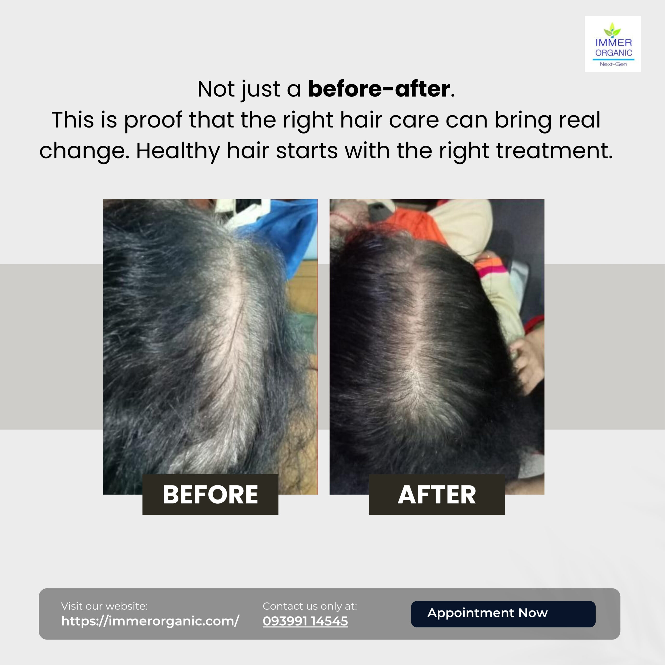 best hair treatment in indore best hair treatment in indore